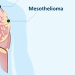 Sporcle profile picture for @Mesothelioma